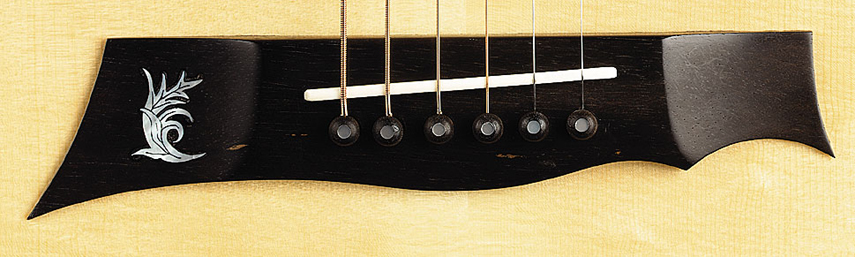 Kehlet Millenium TM 2000 - inlay in bridge